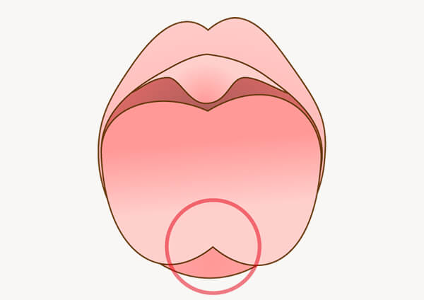 舌小帯・上唇小帯